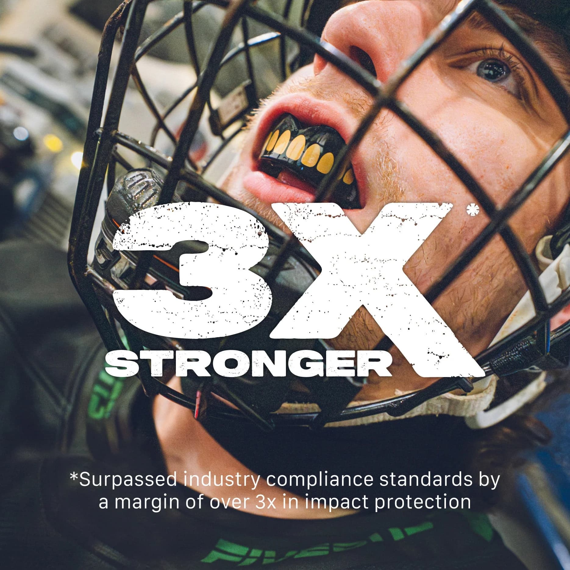SafeJawz 'Goldie' Mouth guard - Extro SEries - Black & Gold – additional SafeJawz photograph
